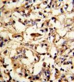 Anti-DFNA5 antibody, N-term used in IHC (Paraffin sections) (IHC-P). GTX81693
