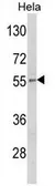 Anti-DFNA5 antibody, N-term used in Western Blot (WB). GTX81693
