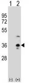 Anti-COLEC11 antibody, N-term used in Western Blot (WB). GTX81694