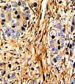 Anti-Laminin beta 2 antibody, C-term used in IHC (Paraffin sections) (IHC-P). GTX81697
