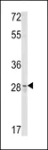 Anti-CUEDC2 antibody, C-term used in Western Blot (WB). GTX81709