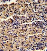 Anti-ALKBH8 antibody, C-term used in IHC (Paraffin sections) (IHC-P). GTX81711