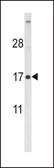 Anti-FSH beta antibody, Internal used in Western Blot (WB). GTX81713