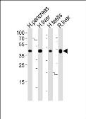 Anti-HMGCS2 antibody, C-term used in Western Blot (WB). GTX81715