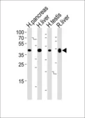 Anti-HMGCS2 antibody, C-term used in Western Blot (WB). GTX81715