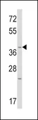 Anti-Wnt1 antibody, C-term used in Western Blot (WB). GTX81721