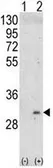 Anti-ITM2A antibody, N-term used in Western Blot (WB). GTX81726