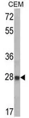 Anti-IGFBP6 antibody, C-term used in Western Blot (WB). GTX81728