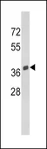 Anti-SPARC antibody, C-term used in Western Blot (WB). GTX81749