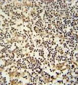 Anti-MAML3 antibody, C-term used in IHC (Paraffin sections) (IHC-P). GTX81755