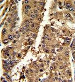 Anti-PSME2 antibody, C-term used in IHC (Paraffin sections) (IHC-P). GTX81770
