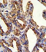 Anti-TACSTD2 antibody, Internal used in IHC (Paraffin sections) (IHC-P). GTX81777