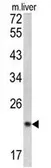 Anti-SPCS3 antibody, C-term used in Western Blot (WB). GTX81778