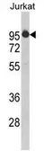 Anti-HTATSF1 antibody, N-term used in Western Blot (WB). GTX81789