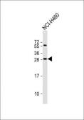 Anti-FGF18 antibody, N-term used in Western Blot (WB). GTX81796