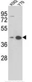 Anti-AZGP1 antibody, N-term used in Western Blot (WB). GTX81802