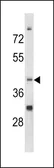 Anti-Nocturnin antibody, C-term used in Western Blot (WB). GTX81810