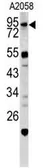 Anti-Caldesmon antibody, Internal used in Western Blot (WB). GTX81812