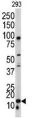 Anti-BAALC antibody, N-term used in Western Blot (WB). GTX81815