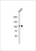 Anti-COL6A1 antibody, C-term used in Western Blot (WB). GTX81823