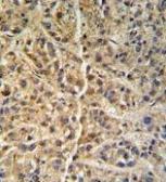 Anti-GNS antibody, Internal used in IHC (Paraffin sections) (IHC-P). GTX81833