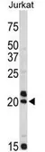 Anti-VIP antibody, C-term used in Western Blot (WB). GTX81846