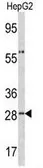Anti-alpha 1 Acid Glycoprotein antibody, C-term used in Western Blot (WB). GTX81862