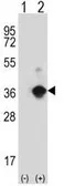 Anti-ANGPTL7 antibody, N-term used in Western Blot (WB). GTX81863