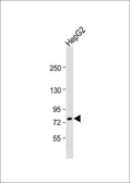 Anti-ABCG1 antibody, Internal used in Western Blot (WB). GTX81867