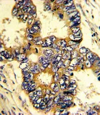 Anti-EPN3 antibody, N-term used in IHC (Paraffin sections) (IHC-P). GTX81869