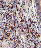 Anti-CNOT8 antibody, C-term used in IHC (Paraffin sections) (IHC-P). GTX81874