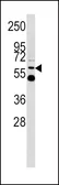 Anti-UGT2B17 antibody, Internal used in Western Blot (WB). GTX81884