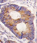 Anti-Frataxin antibody, Internal used in IHC (Paraffin sections) (IHC-P). GTX81888