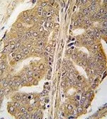 Anti-Paxillin antibody used in IHC (Paraffin sections) (IHC-P). GTX81889