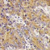 Anti-Myosin 1C antibody, C-term used in IHC (Paraffin sections) (IHC-P). GTX81898