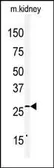 Anti-Claudin 2 antibody, C-term used in Western Blot (WB). GTX81900