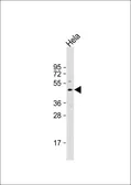 Anti-YB1 antibody, N-term used in Western Blot (WB). GTX81910