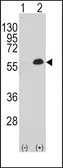 Anti-MEF2C antibody used in Western Blot (WB). GTX81913