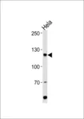 Anti-HIRA antibody, Internal used in Western Blot (WB). GTX81928