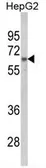 Anti-hnRNP L antibody, C-term used in Western Blot (WB). GTX81942