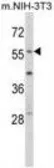 Anti-EGR1 antibody, N-term used in Western Blot (WB). GTX81956