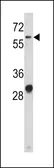 Anti-CD166 antibody, N-term used in Western Blot (WB). GTX81961