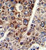 Anti-CD38 antibody, C-term used in IHC (Paraffin sections) (IHC-P). GTX81962
