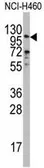 Anti-Exonuclease 1 antibody, N-term used in Western Blot (WB). GTX81967