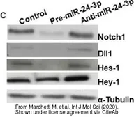 Anti-HEY1 antibody used in Western Blot (WB). GTX82287