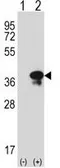 Anti-Syntaxin 3 antibody, Internal used in Western Blot (WB). GTX82488