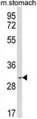 Anti-SC35 antibody, Internal used in Western Blot (WB). GTX82500