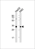 Anti-SC35 antibody, N-term used in Western Blot (WB). GTX82501