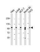 Anti-EZH2 antibody used in Western Blot (WB). GTX82503