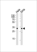 Anti-SNAI1 antibody, N-term used in Western Blot (WB). GTX82509